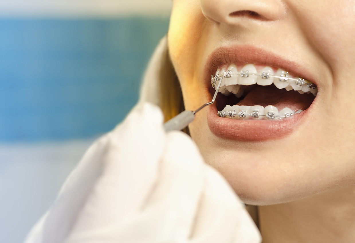 Common Dental Concerns & How To Prevent Them